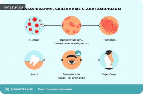 Зимний авитаминоз: причины, симптомы и способы борьбыЗимний авитаминоз: причины, симптомы и способы борьбы